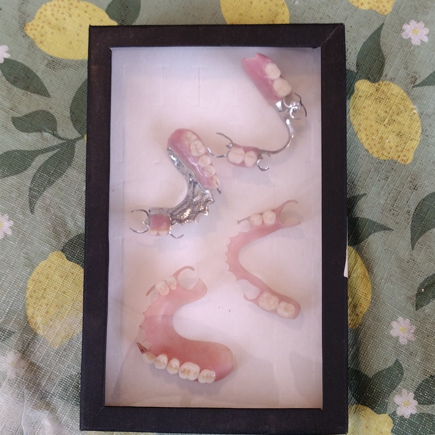 Vintage Dental Removable Partial Denture Acrylic Resin w/ Metal Clasps Pink