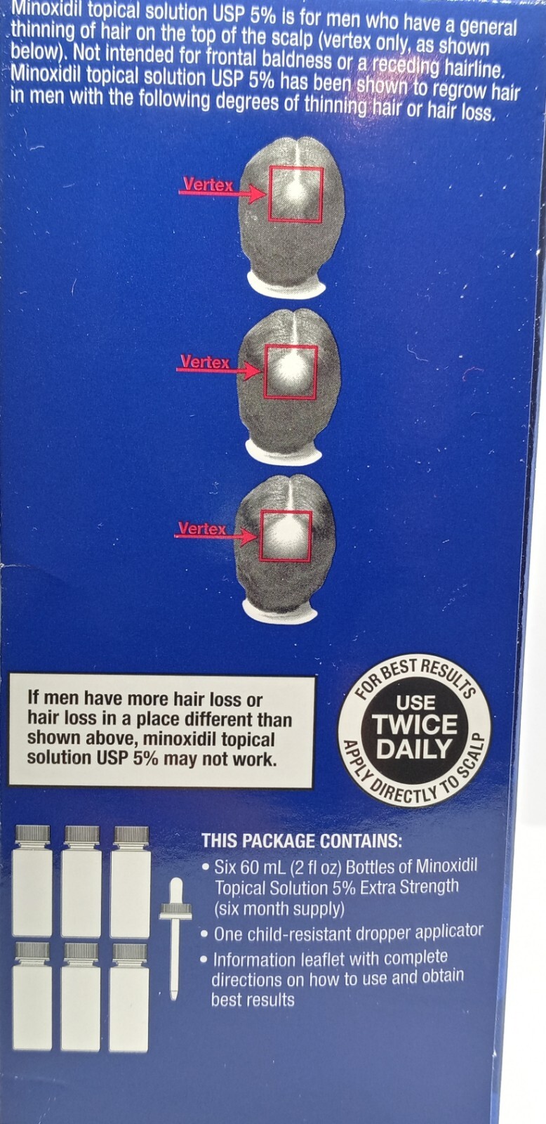 Member’s Mark 5% Minoxidil Topical Solution Hair Regrowth Treatment 1 – 6 Months