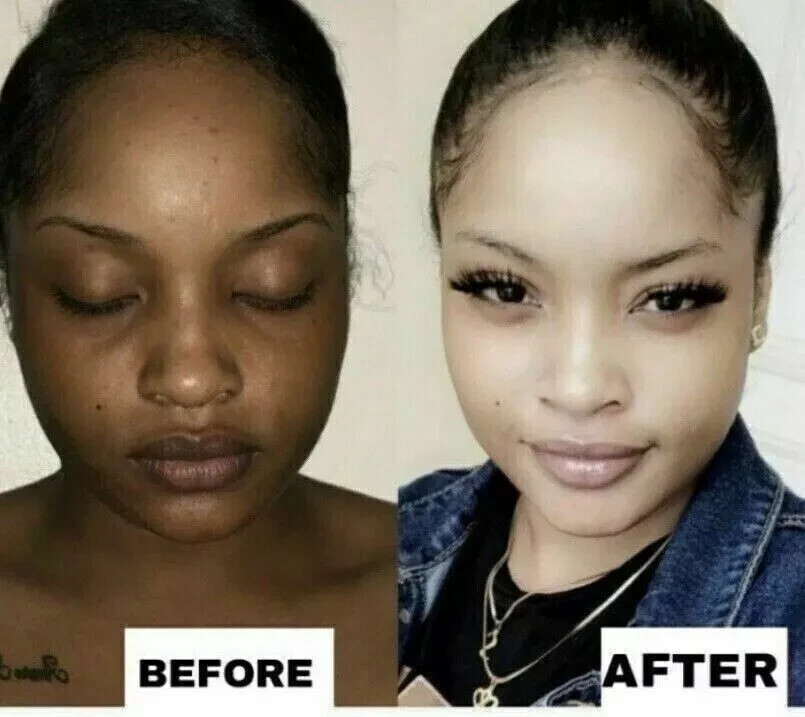 2*Skin Lightening Cream Extra Strength Lighter FAST Result-NO SIDE EFFECT