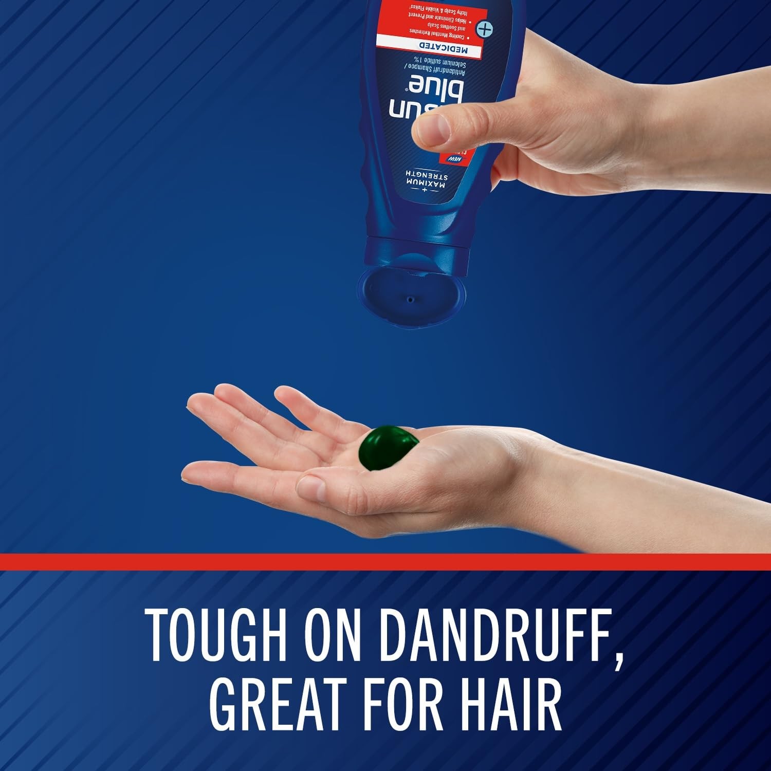 Selsun Blue Medicated Antidandruff Shampoo, 11 Fl Oz (Pack of 1),