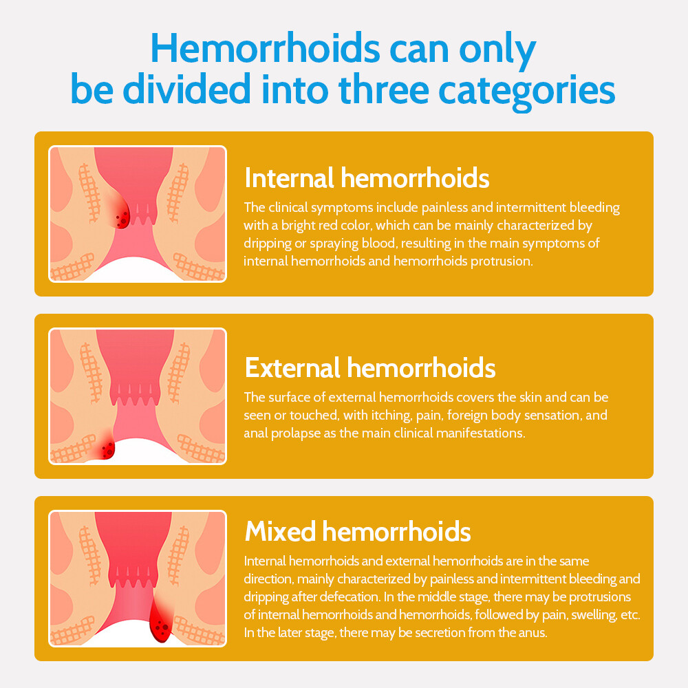 Hemorrhoids Remove Ointment Herbal Cream Relief Piles Pain Reduce Itching SALE
