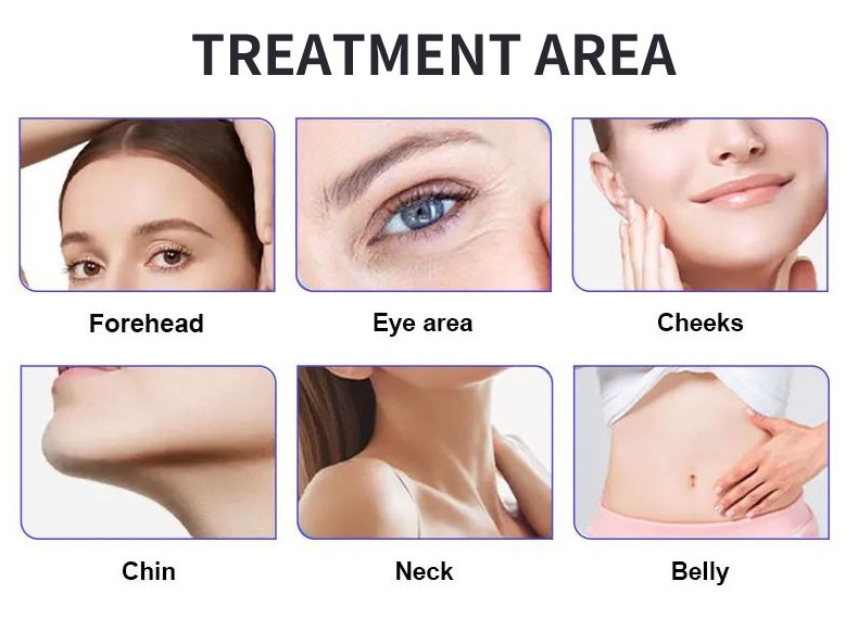 2in1 RF Micro-n-eedle Machine Cold Hammer Anti Scars Spot Wrinkle Removal Beauty