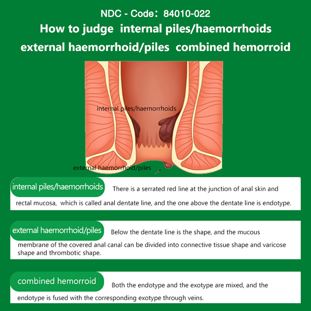 Hemorrhoid Cream Haemorrhoids Fissure Gel Piles Anal Fissure Prolapse Ointment
