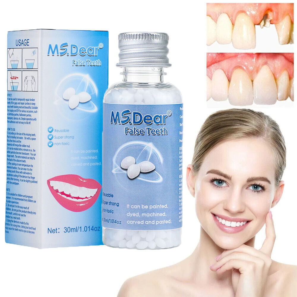 5/3x Tooth Repair Granules Temporary Reusable Moldable False Teeth Fitting Beads