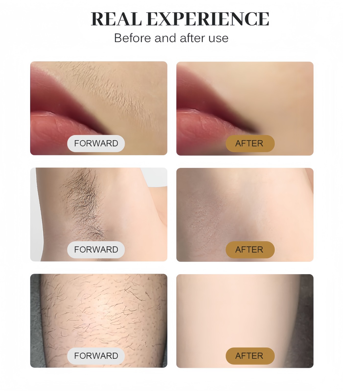 Pro 2 in 1 Diode Laser Hair Removal Machine Picosecond Tattoo Removal Instrument