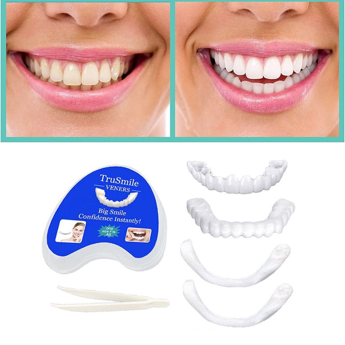 Snap On Veneers Upper & Lower Set – Instant Smile Removable Teeth No Glue yjr