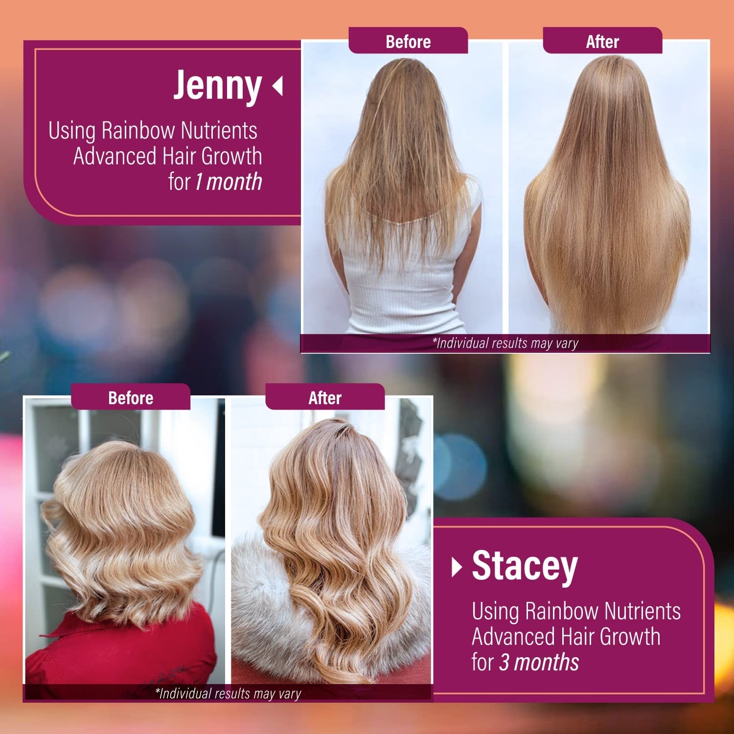 Hair Growth Vitamins for Women | Biotin 10000mcg Collagen Patented OptiMSM? g…