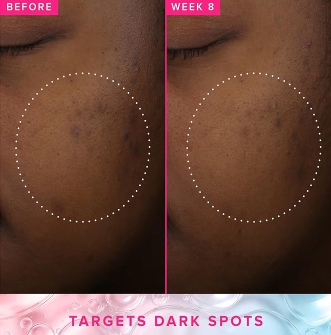 Farmacy Brighten On Foam Cleanser Exfoliator & Brighten Up Dark Spot Toner Set