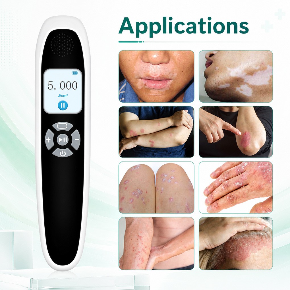 Non Invasive 308nm UVB Light Therapy Device for Skin Health and Natural Repair
